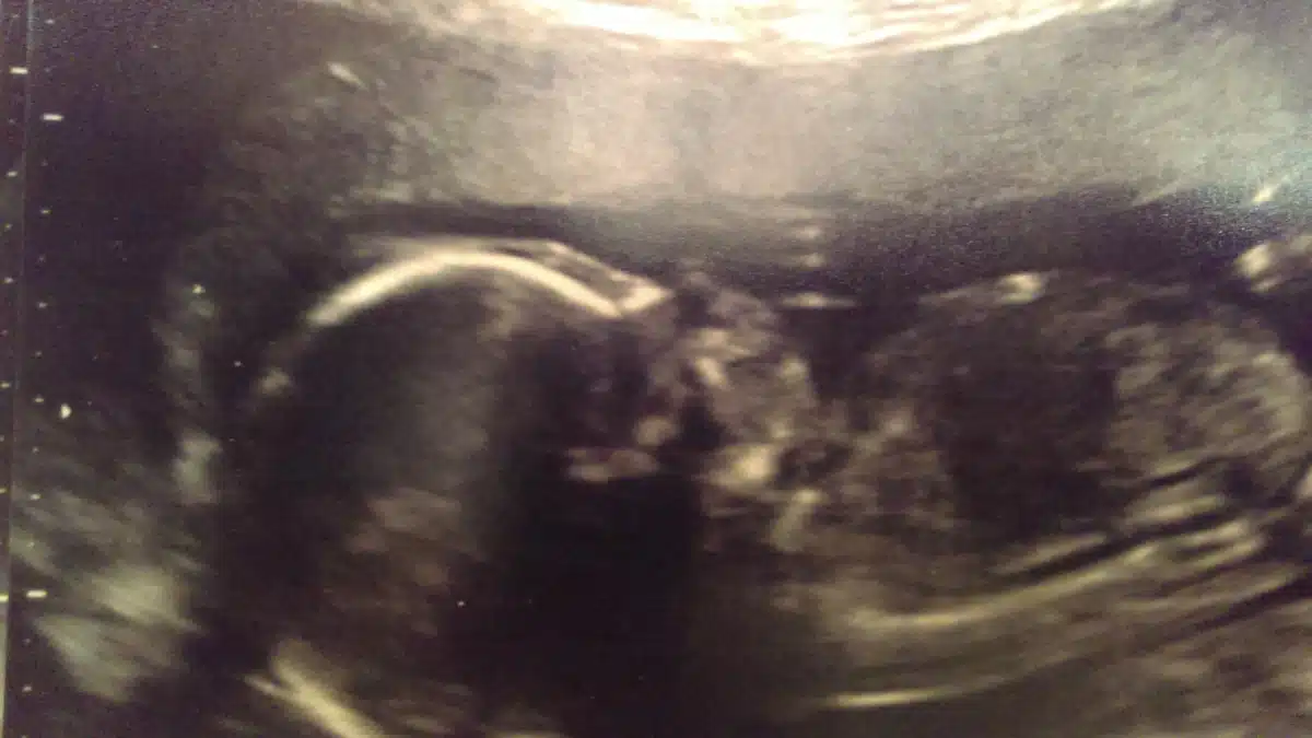 Amity Foundation - Thumbnail 10